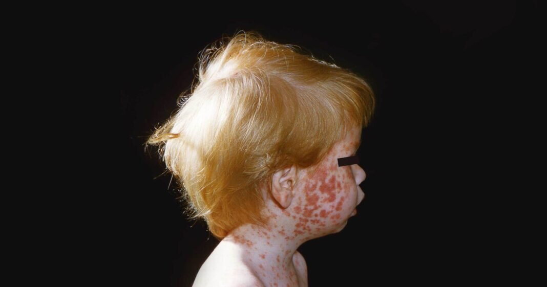 how-robert-f-kennedy-jr.’s-vaccine-agenda-risks-a-resurgence-of-deadly-childhood-plagues