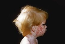 how-robert-f-kennedy-jr.’s-vaccine-agenda-risks-a-resurgence-of-deadly-childhood-plagues