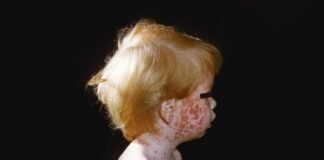 how-robert-f-kennedy-jr.’s-vaccine-agenda-risks-a-resurgence-of-deadly-childhood-plagues