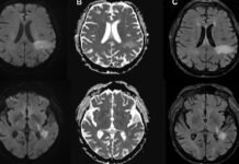 you’re-likely-already-infected-with-a-brain-eating-virus-you’ve-never-heard-of