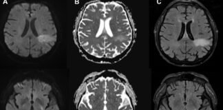 you’re-likely-already-infected-with-a-brain-eating-virus-you’ve-never-heard-of