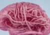 what’s-the-deal-with-alzheimer’s-disease-and-amyloid?