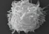 man-dies-covered-in-necrotic-lesions-after-amoebas-eat-him-alive