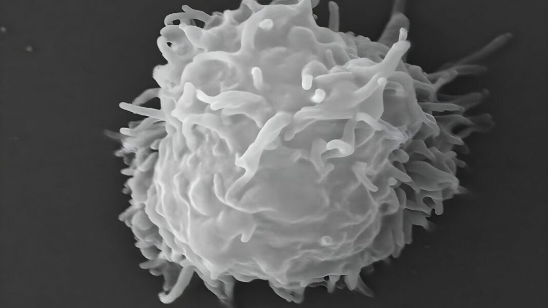 man-dies-covered-in-necrotic-lesions-after-amoebas-eat-him-alive