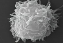 man-dies-covered-in-necrotic-lesions-after-amoebas-eat-him-alive