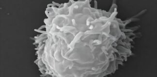 man-dies-covered-in-necrotic-lesions-after-amoebas-eat-him-alive