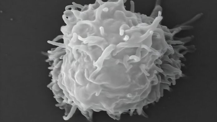 man-dies-covered-in-necrotic-lesions-after-amoebas-eat-him-alive