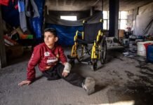 1-in-5-amputees-in-gaza-is-a-child,-un-warns-amid-prosthetic-care-crisis