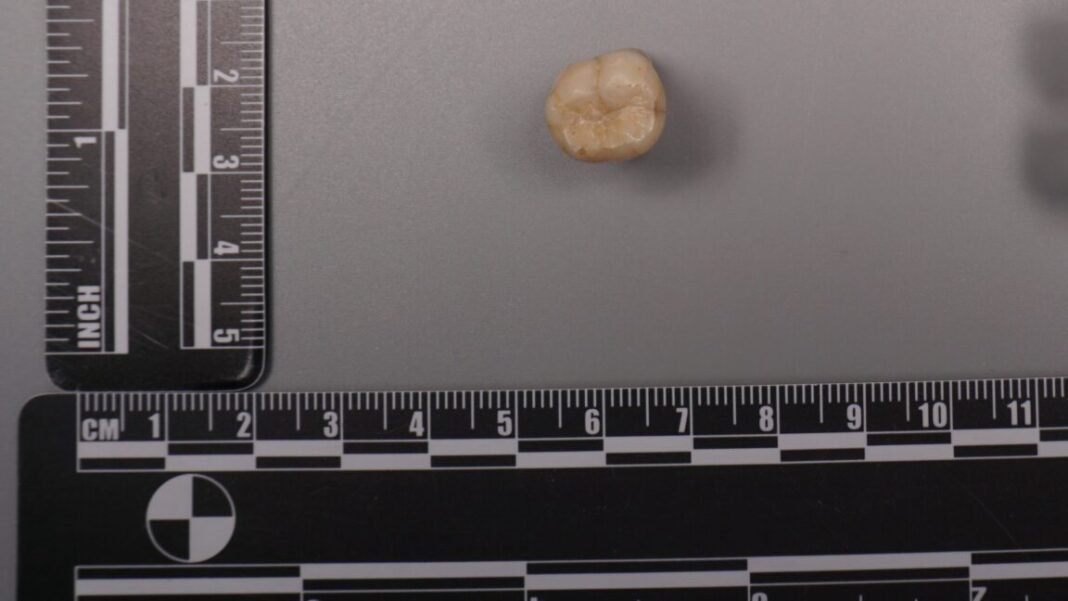 protein-in-homo-erectus-teeth-suggests-denisovans-gave-us-some-of-their-dna