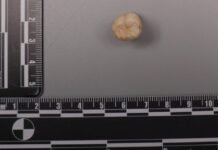 protein-in-homo-erectus-teeth-suggests-denisovans-gave-us-some-of-their-dna