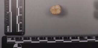 protein-in-homo-erectus-teeth-suggests-denisovans-gave-us-some-of-their-dna