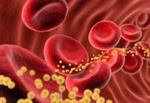 bad-cholesterol-slashed-62%-by-single-dose-of-gene-editing-drug-in-small-trial