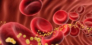 bad-cholesterol-slashed-62%-by-single-dose-of-gene-editing-drug-in-small-trial