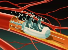 More Than $100 Million Was Billed for Medically Questionable Vascular Procedures, Government Watchdog Finds more-than-$100-million-was-billed-for-medically-questionable-vascular-procedures,-government-watchdog-finds