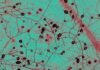 this-unfathomably-huge-fungal-network-keeps-earth-cool-and-green