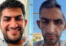 ‘shocking’-photo-of-freed-palestinian-journalist-shows-‘tragic’-conditions-in-israeli-prisons:-rights-group