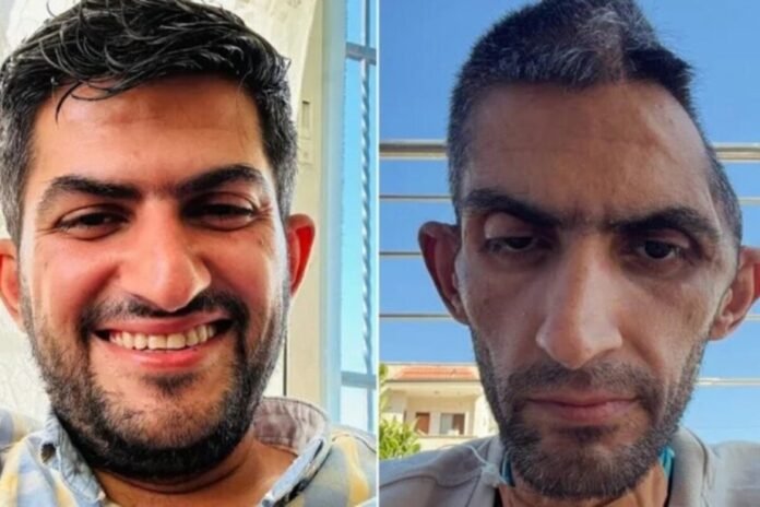 ‘shocking’-photo-of-freed-palestinian-journalist-shows-‘tragic’-conditions-in-israeli-prisons:-rights-group