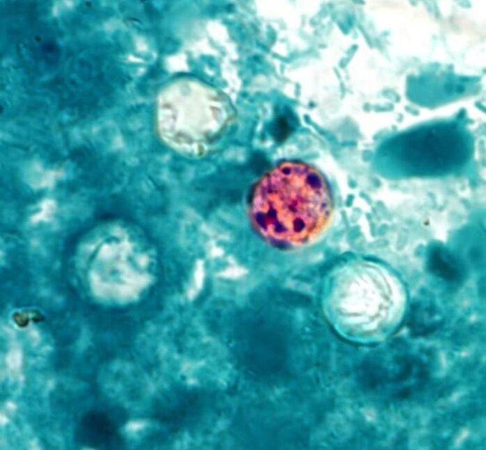 michigan-sees-explosive-outbreak-of-diarrheal-parasite-with-over-700-cases