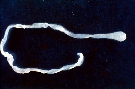 surprised-doctors-find-10-inch-worm-in-man’s-groin-during-elective-surgery surprised-doctors-find-10-inch-worm-in-man’s-groin-during-elective-surgery