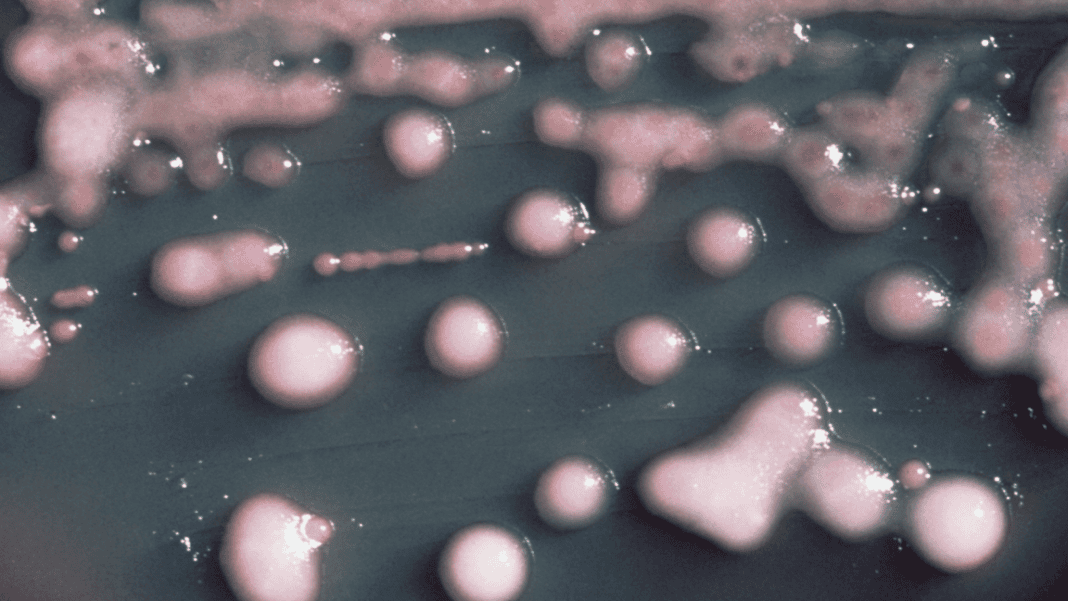 a-woman-got-a-uti-two-years-later,-the-bacteria-had-evolved,-invaded-her-brain. a-woman-got-a-uti-two-years-later,-the-bacteria-had-evolved,-invaded-her-brain.