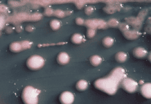 a-woman-got-a-uti-two-years-later,-the-bacteria-had-evolved,-invaded-her-brain.
