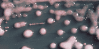 A woman got a UTI. Two years later, the bacteria had evolved, invaded her brain. a-woman-got-a-uti-two-years-later,-the-bacteria-had-evolved,-invaded-her-brain.