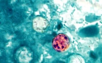 FDA reports new outbreak of explosive diarrhea with 72 cases identified fda-reports-new-outbreak-of-explosive-diarrhea-with-72-cases-identified