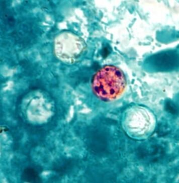 FDA reports new outbreak of explosive diarrhea with 72 cases identified fda-reports-new-outbreak-of-explosive-diarrhea-with-72-cases-identified