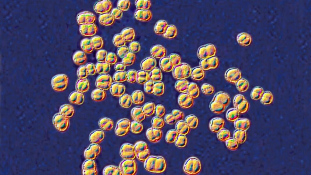 college-lab-class-ends-with-32-people-on-antibiotics-for-deadly-germ-exposure