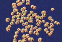 college-lab-class-ends-with-32-people-on-antibiotics-for-deadly-germ-exposure