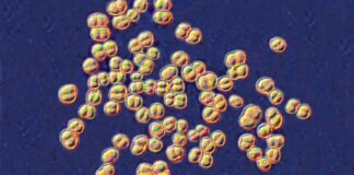 college-lab-class-ends-with-32-people-on-antibiotics-for-deadly-germ-exposure