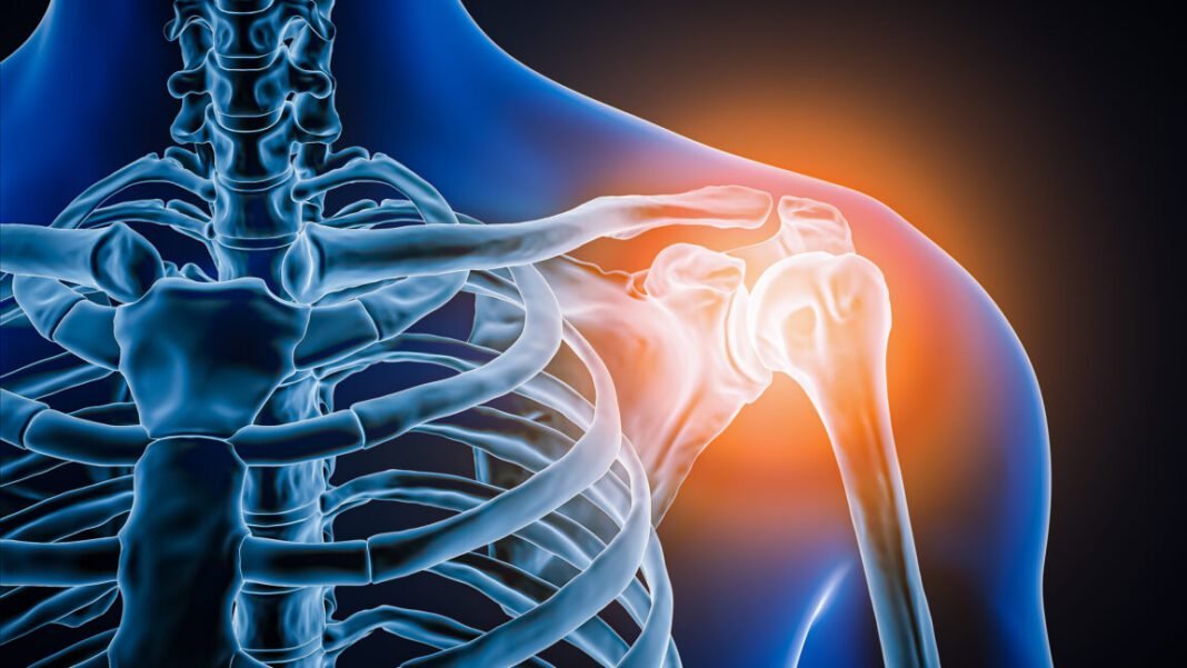 doctors-took-a-look-at-man’s-painful-shoulder—they-found-the-joint-was-missing