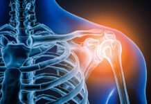 Doctors took a look at man’s painful shoulder—they found the joint was missing doctors-took-a-look-at-man’s-painful-shoulder—they-found-the-joint-was-missing