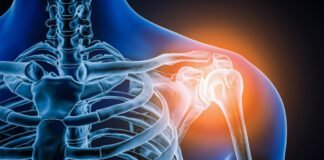 doctors-took-a-look-at-man’s-painful-shoulder—they-found-the-joint-was-missing