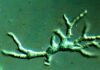 an-ultra-rare-amoeba-was-destroying-a-toddler’s-brain-doctors-missed-it.