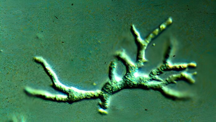 an-ultra-rare-amoeba-was-destroying-a-toddler’s-brain-doctors-missed-it.