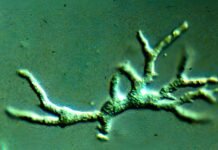 toddler’s-tragic-death-from-brain-destroying-amoeba-offers-lessons-for-doctors