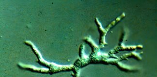 toddler’s-tragic-death-from-brain-destroying-amoeba-offers-lessons-for-doctors