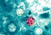 trump-admin-shelves-cyclospora-research-despite-record-breaking-outbreak