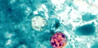 Trump admin shelves Cyclospora research despite record-breaking outbreak trump-admin-shelves-cyclospora-research-despite-record-breaking-outbreak