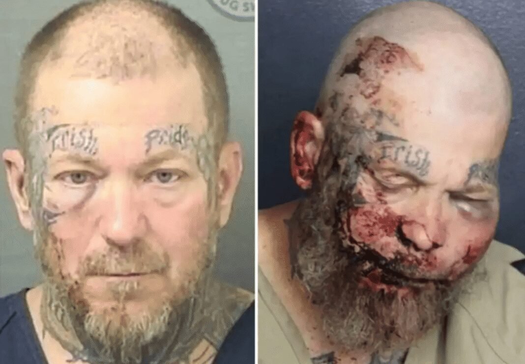man-left-swollen-and-bloodied-after-he-attacks-cop-in-hospital man-left-swollen-and-bloodied-after-he-attacks-cop-in-hospital