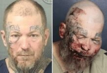 man-left-swollen-and-bloodied-after-he-attacks-cop-in-hospital