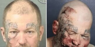 man-left-swollen-and-bloodied-after-he-attacks-cop-in-hospital