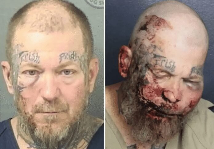 man-left-swollen-and-bloodied-after-he-attacks-cop-in-hospital