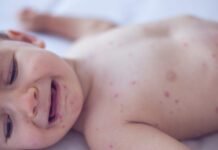 Measles killed 6-week-old baby, coroner confirms after RFK Jr. disputed deaths measles-killed-6-week-old-baby,-coroner-confirms-after-rfk-jr.-disputed-deaths