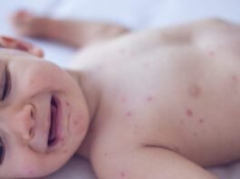 measles-killed-6-week-old-baby,-coroner-confirms-after-rfk-jr.-disputed-deaths