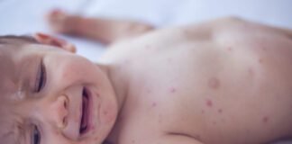 measles-killed-6-week-old-baby,-coroner-confirms-after-rfk-jr.-disputed-deaths