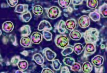 Unvaccinated Pennsylvania woman died of measles complications, coroner says unvaccinated-pennsylvania-woman-died-of-measles-complications,-coroner-says