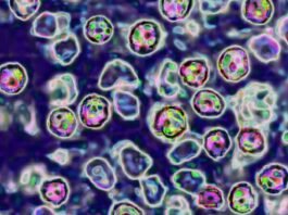Unvaccinated Pennsylvania woman died of measles complications, coroner says unvaccinated-pennsylvania-woman-died-of-measles-complications,-coroner-says