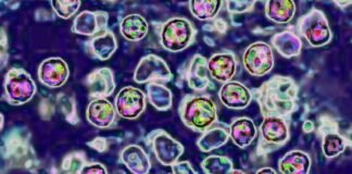 Unvaccinated Pennsylvania woman died of measles complications, coroner says unvaccinated-pennsylvania-woman-died-of-measles-complications,-coroner-says
